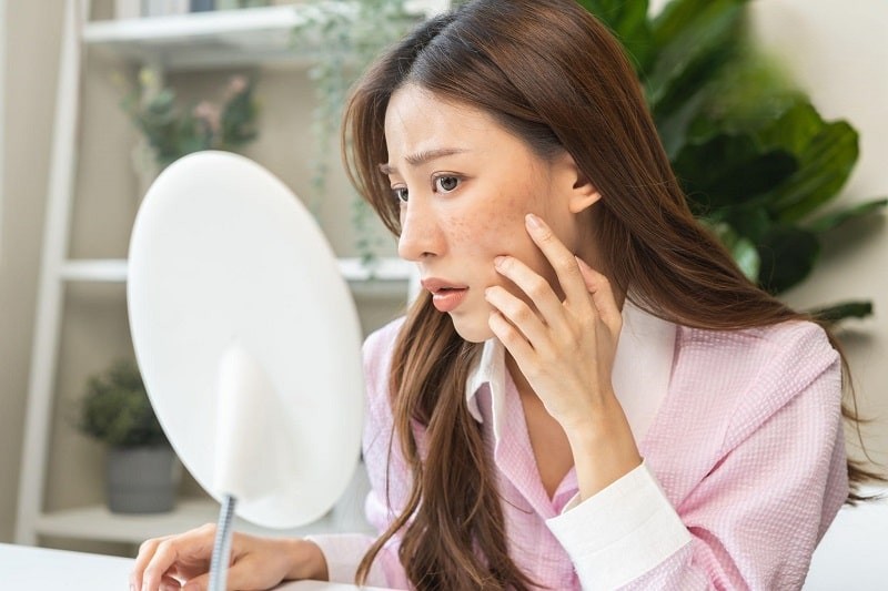 Lão hóa da là nỗi lo sợ của nhiều phụ nữ