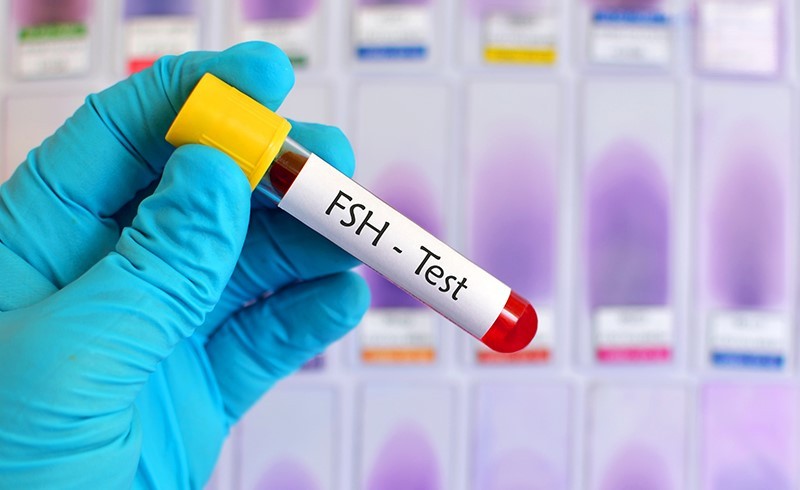 FSH là một nội tiết tố sinh dục quan trọng, đặc biệt là ở nữ giới