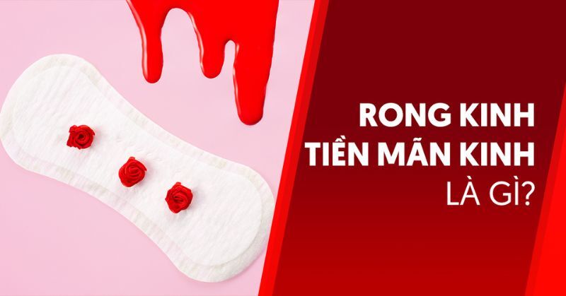rong kinh tiền mãn kinh