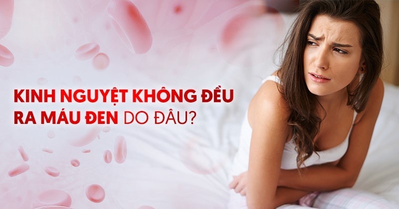 Kinh nguyệt không đều ra máu đen: Nguyên nhân và cách điều trị