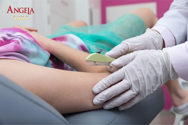 Que tránh thai hoạt động như thế nào?