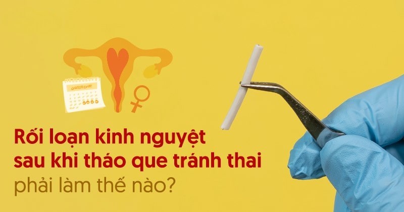 Rối loạn kinh nguyệt sau khi tháo que tránh thai: Nguyên nhân và khắc phục
