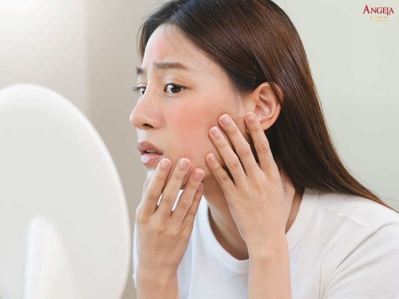 Hạn chế chạm tay vào da mặt