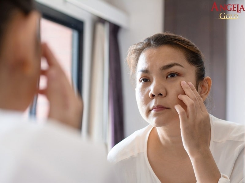 Làn da tuổi 30 sẽ gặp những vấn đề gì?
