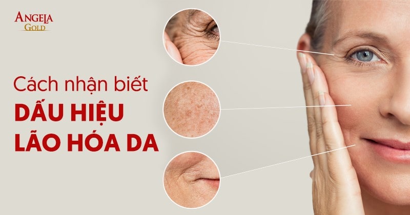 Top 7 dấu hiệu lão hóa da dễ nhận biết chị em cần lưu ý ngay