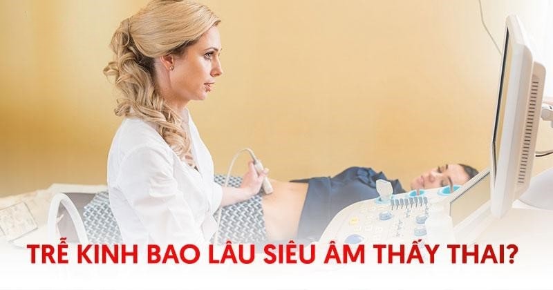 Trễ kinh bao lâu thì siêu âm thấy thai? Chuyên gia giải đáp