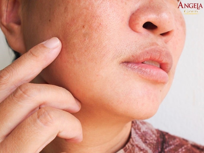 Lạm dụng mỹ phẩm
