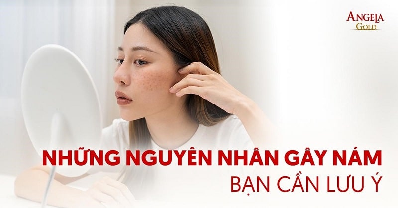 10 nguyên nhân gây nám da mặt được các chuyên gia chỉ đích danh