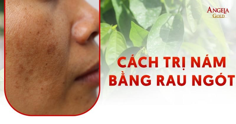 8 cách trị nám bằng rau ngót đơn giản tại nhà áp dụng ngay