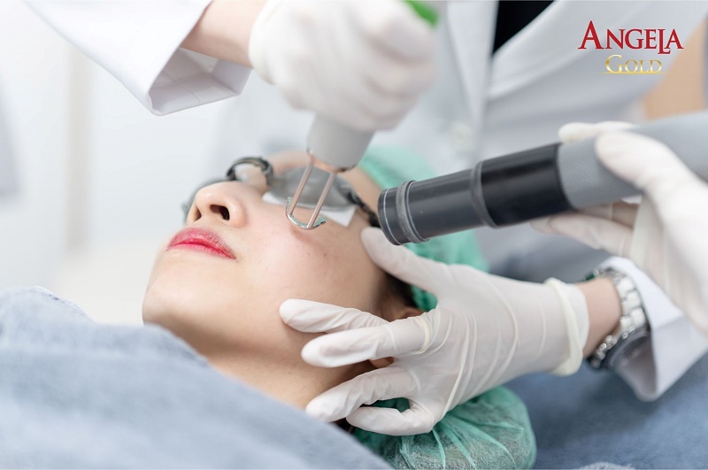 Điều trị nám chân sâu bằng laser