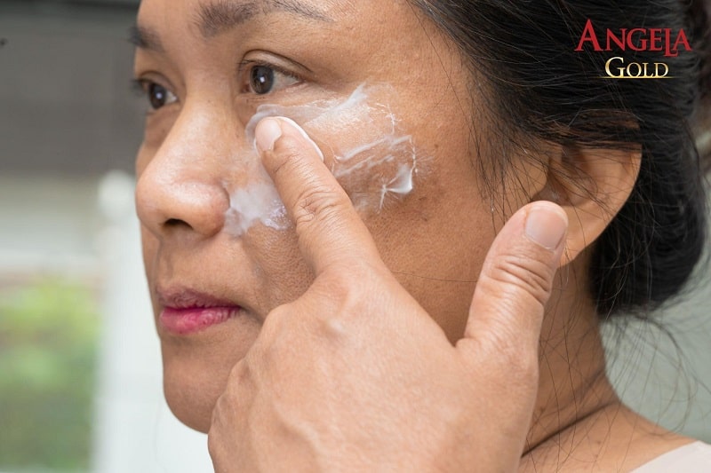 Nguyên nhân ngoại sinh gây nám