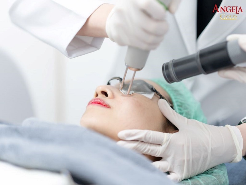 Những cách trị nám chân đinh khoa học hiệu quả cao