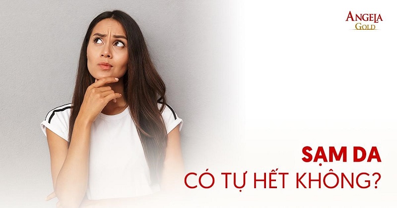 Sạm da có tự hết không? Phương pháp điều trị nào an toàn cho da?