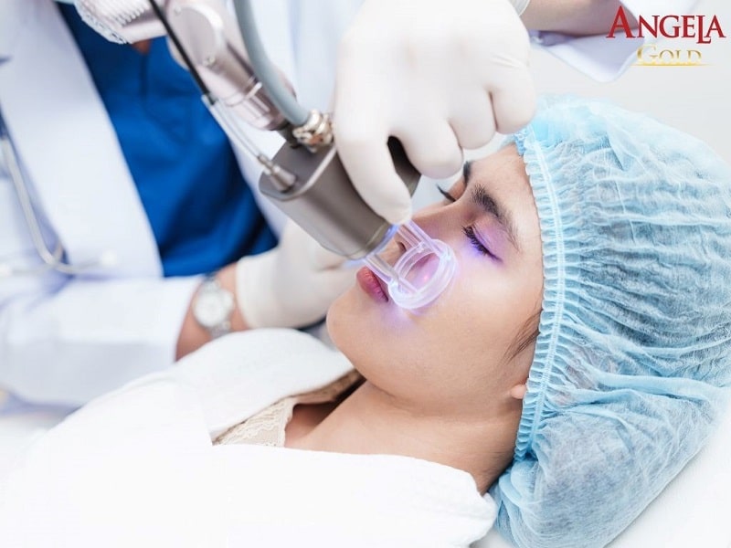 Những biến chứng gặp phải trong quá trình điều trị nám lâu năm?