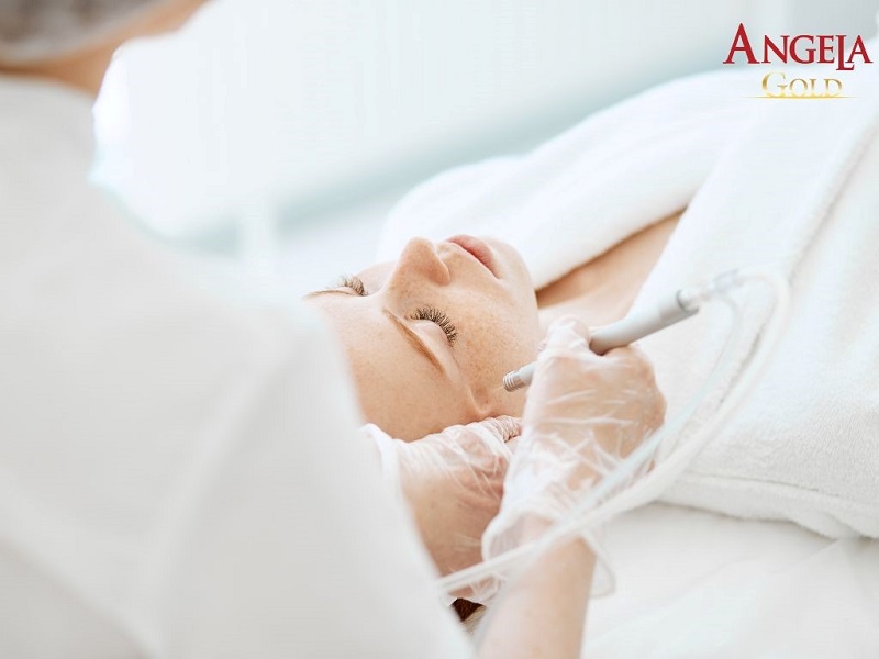 Nám lâu năm có thể trị được bằng bột đậu xanh không