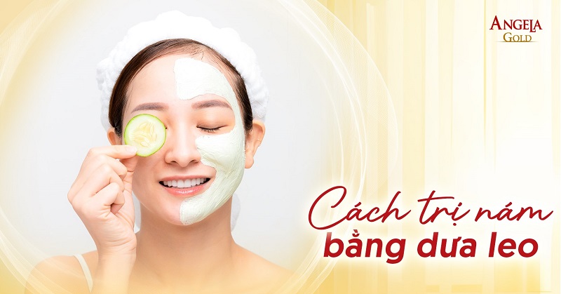 16 cách trị nám bằng dưa leo đơn giản, hiệu quả an toàn tại nhà