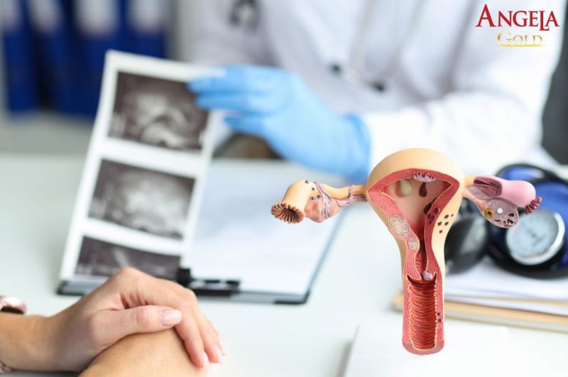 U xơ tử cung sau mãn kinh thường có xu hướng co nhỏ lại, tuy nhiên người bệnh vẫn không nên chủ quan mà cần theo dõi định kỳ