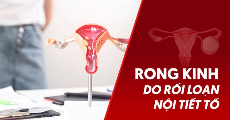 Phụ nữ bị rong kinh do rối loạn nội tiết tố nên làm gì để kiểm soát?