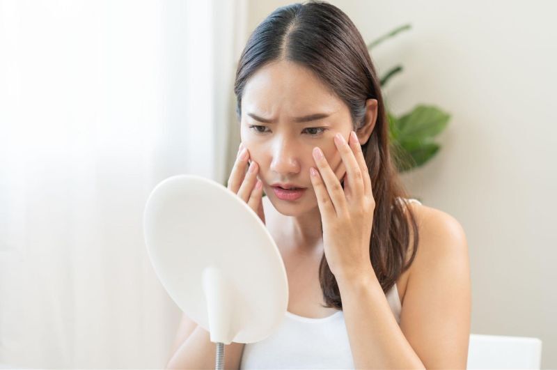 Dấu hiệu cần skincare