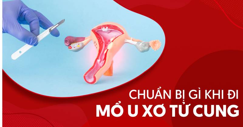 Bạn cần chuẩn bị gì khi đi mổ u xơ tử cung để cảm giác an tâm?