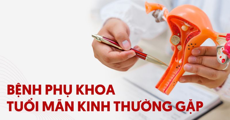 Các bệnh phụ khoa tuổi mãn kinh thường gặp