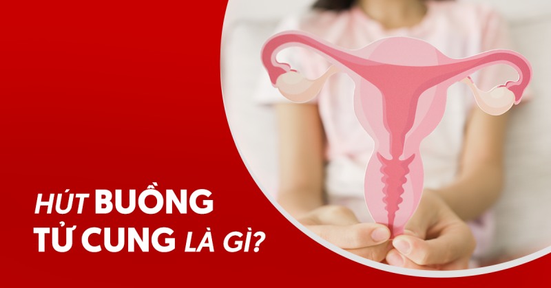 Hút buồng tử cung có đau không? Gây ảnh hưởng gì?