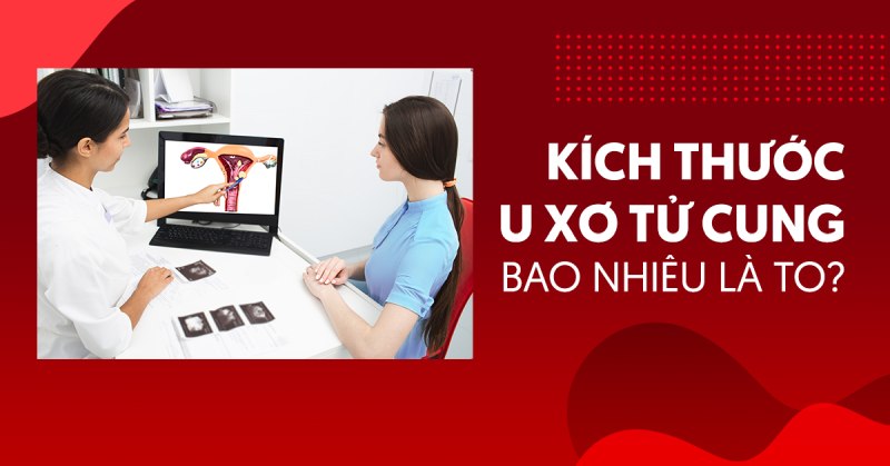 Kích thước u xơ tử cung bao nhiêu là to và cần mổ?