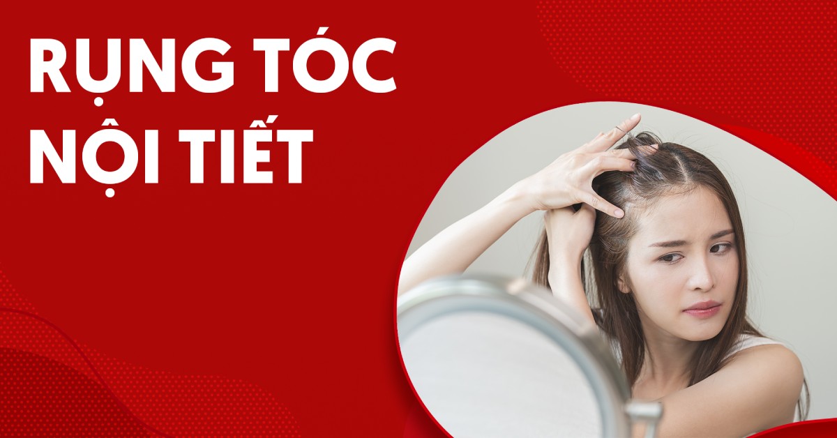 Rụng tóc nội tiết phải làm sao để cải thiện?